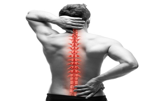 Cervical Spondyliosis  Naturopathy 2
